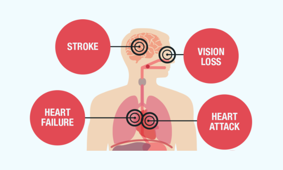 why is hypertension called the silent killer