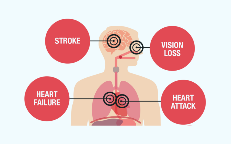why is hypertension called the silent killer